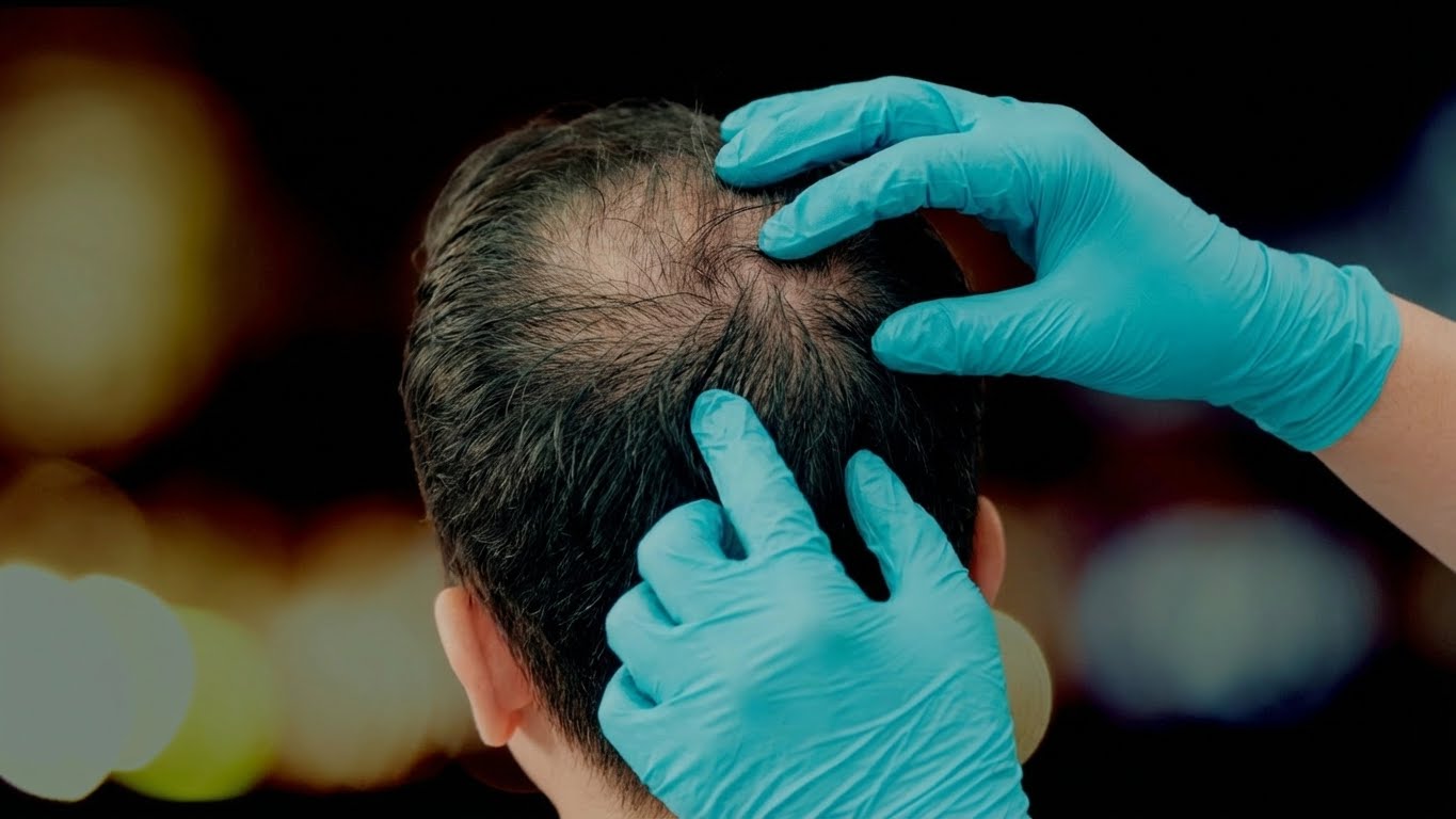 Professional topical scalp and hair application